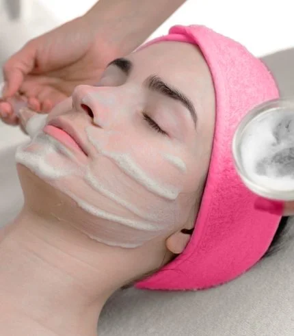 Peeling Químico