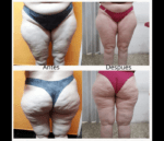 Velaslim Plus - 1 Zona - Imagen 2