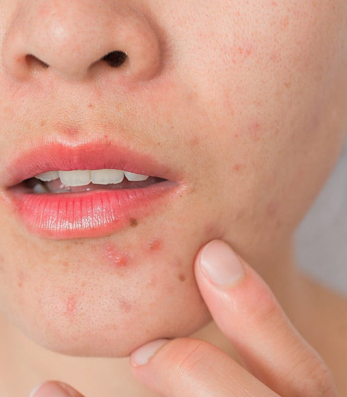 extracciones_portada