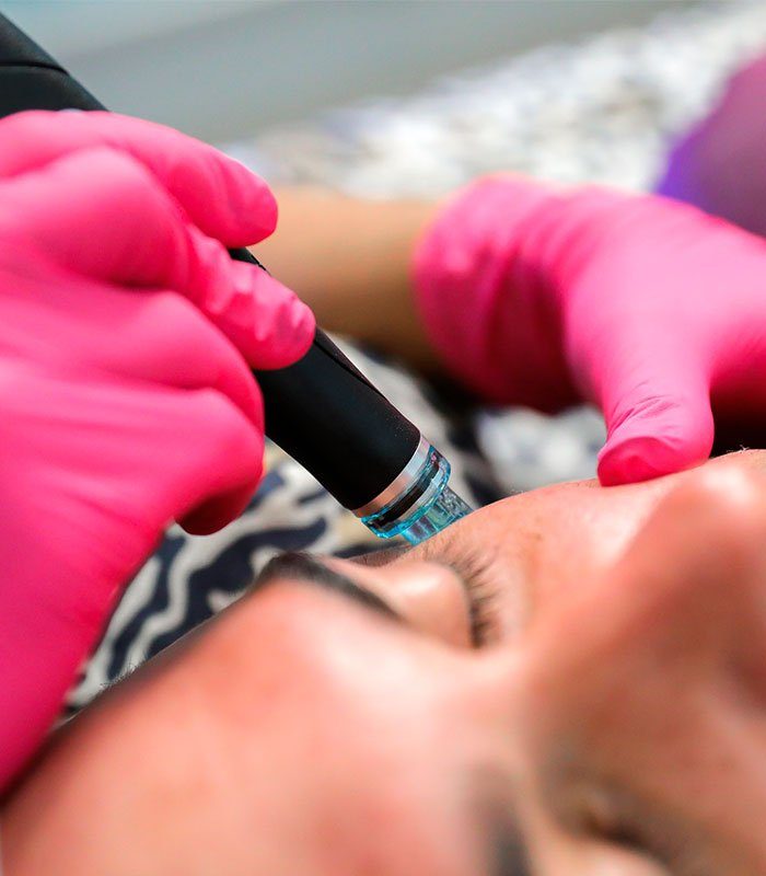 hydra-facial-portada