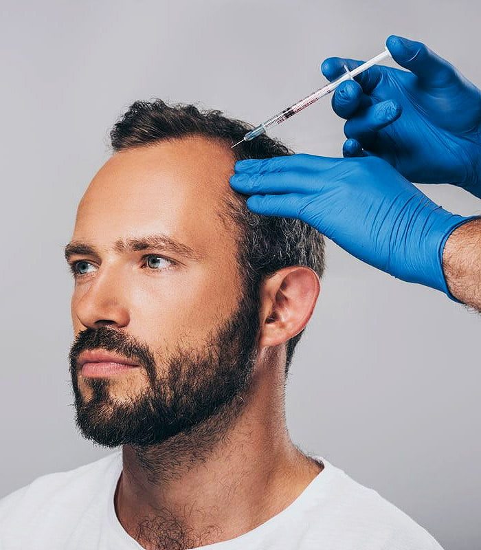 mesoterapia_capilar_portada