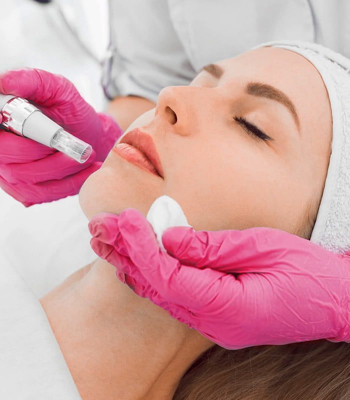 microneedling_portada