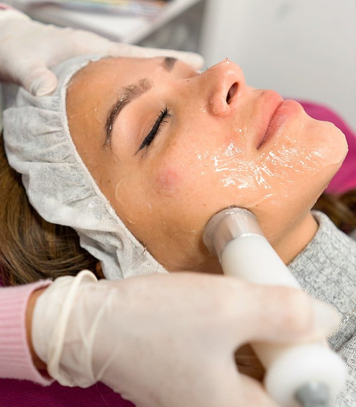 radiofrecuencia facial