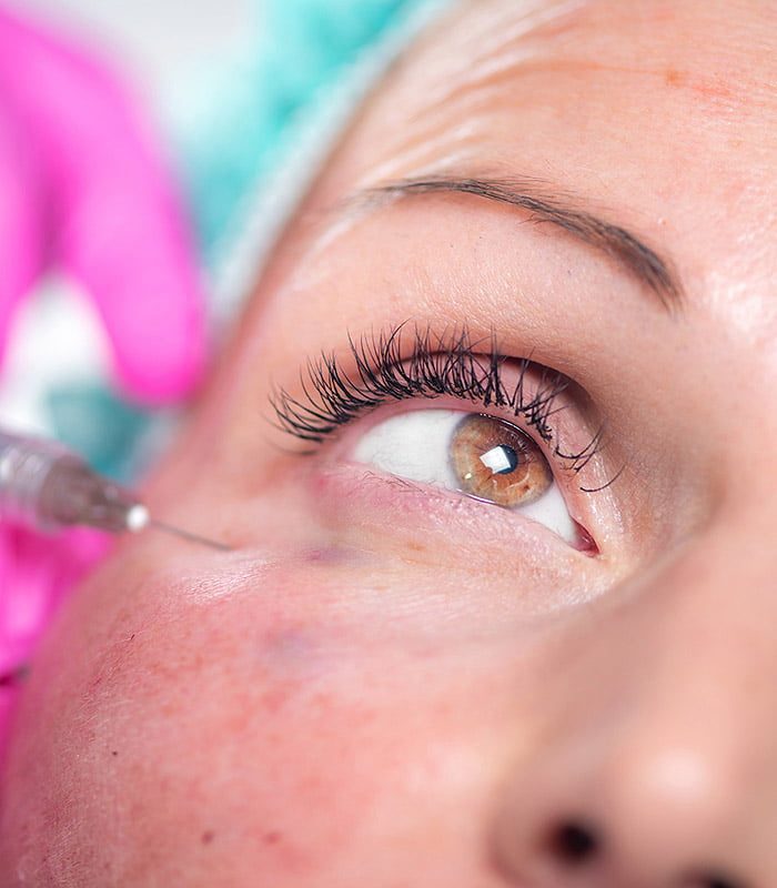 relleno_acido_hialuronico_portada