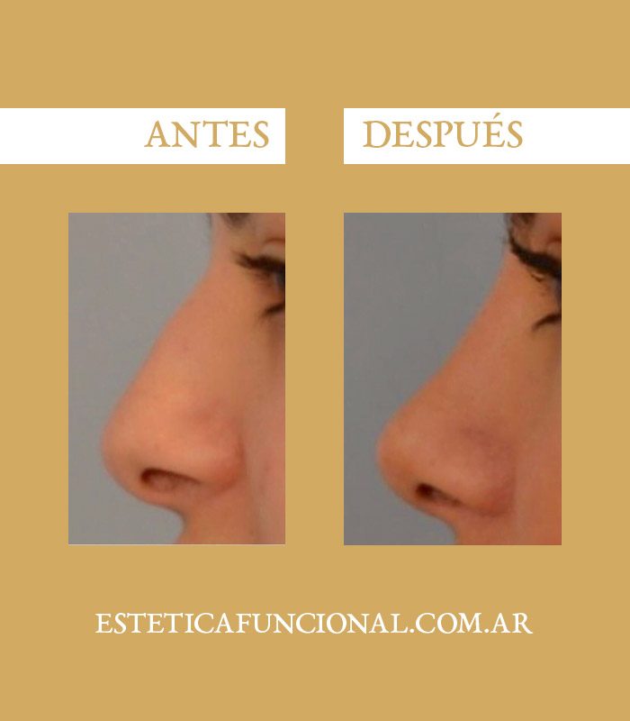 rinomodelacion_portada_03